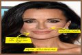 Botox, Implants & More! – Hollywood Life