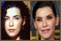 Julianna Margulies Doesn’t Look Natural After Plastic Surgery!