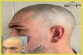 Unveiling The Truth: Steve Austin's Baldness Decoded